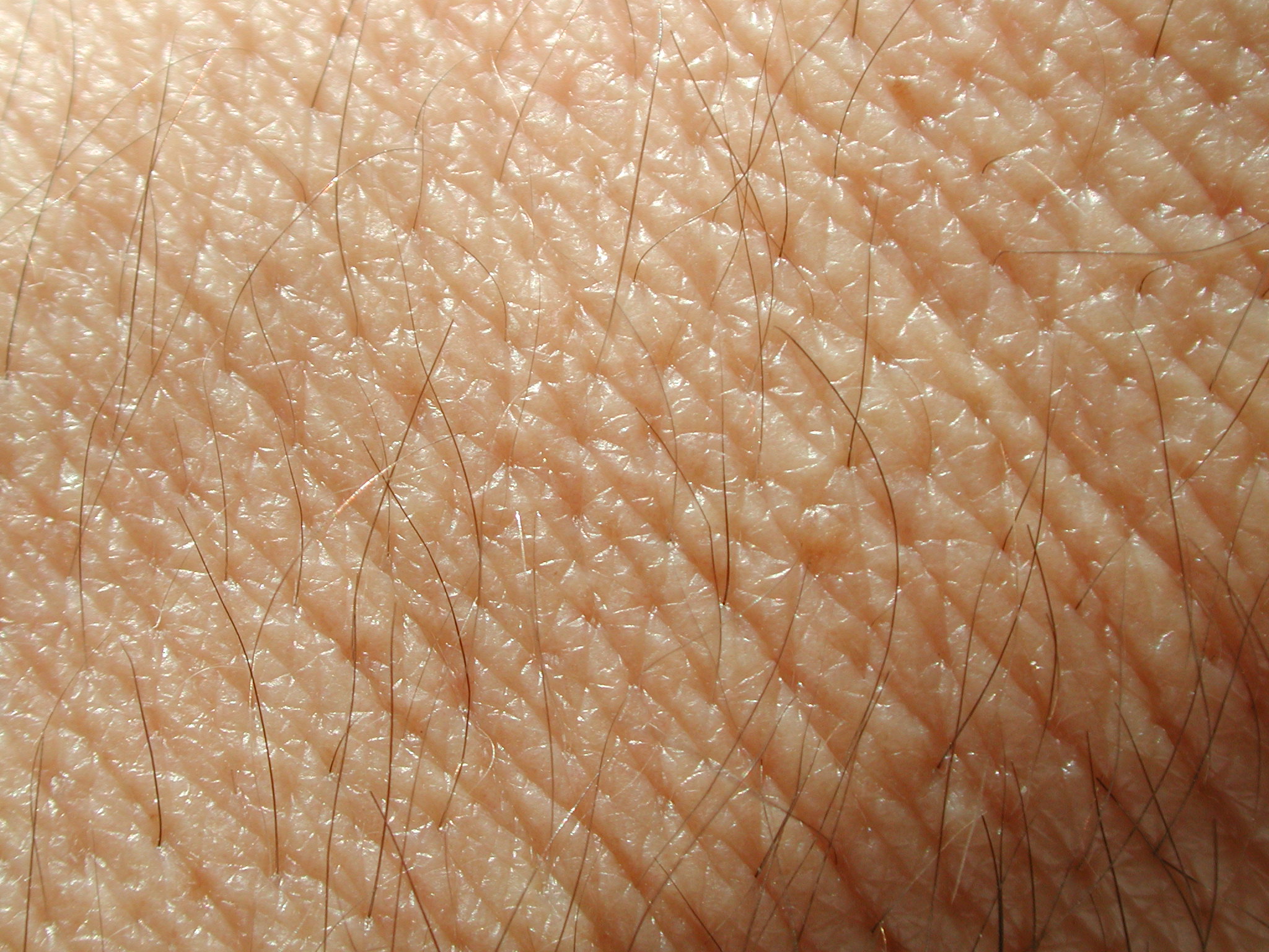 skin